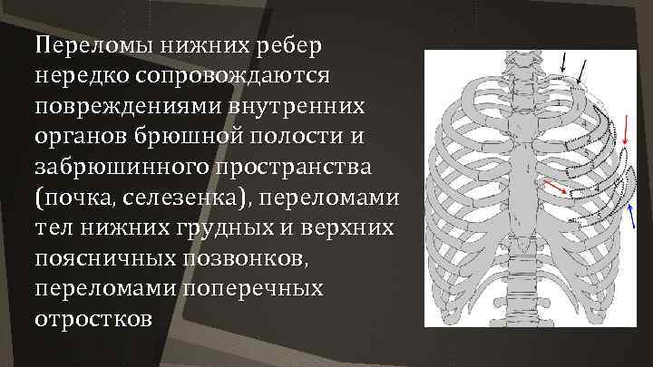 Переломы нижних ребер нередко сопровождаются повреждениями внутренних органов брюшной полости и забрюшинного пространства (почка,