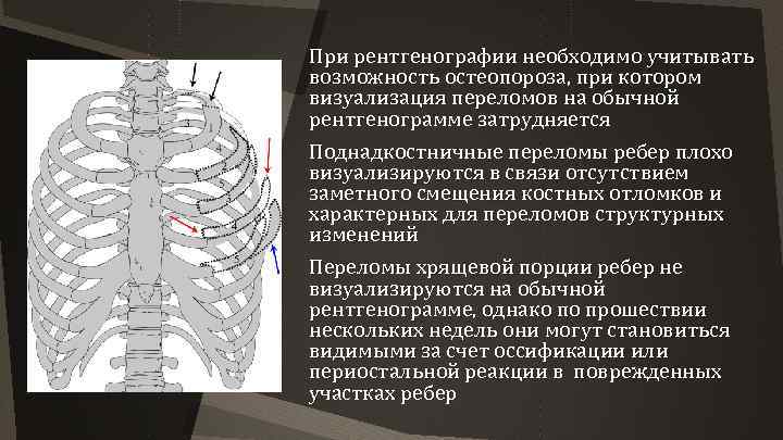 При рентгенографии необходимо учитывать возможность остеопороза, при котором визуализация переломов на обычной рентгенограмме затрудняется