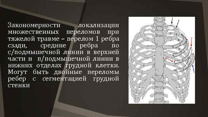 Множественные переломы ребер карта вызова