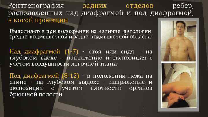 Рентгенография задних отделов ребер, расположенных над диафрагмой и под диафрагмой, в косой проекции Выполняется