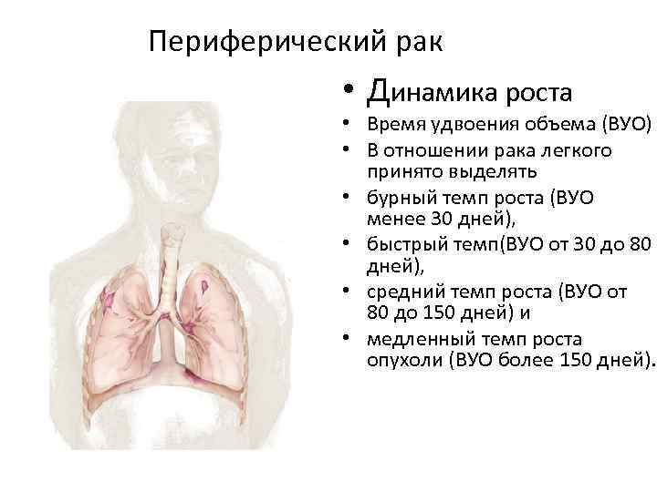 Как выглядит периферический рак легкого на компьютерной томографии