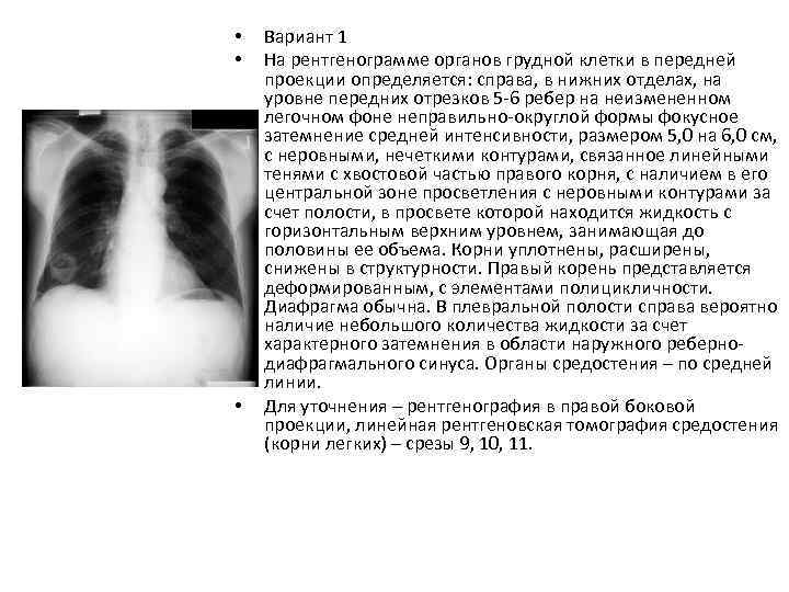 План описания рентгенограммы легких