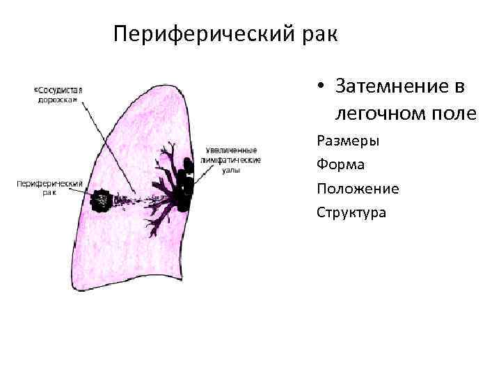 Использование периферического зрения при восприятии рентгеновского изображения