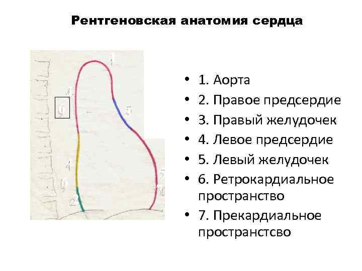 Рентгеновская анатомия сердца 1 1 6 3 4 6 2 5 7 1. Аорта