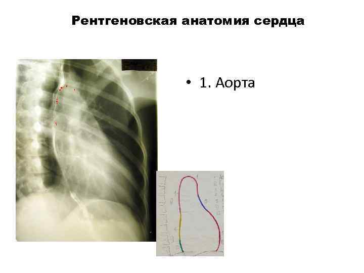 Рентгеновская анатомия сердца 1 • 1. Аорта 3 5 7 