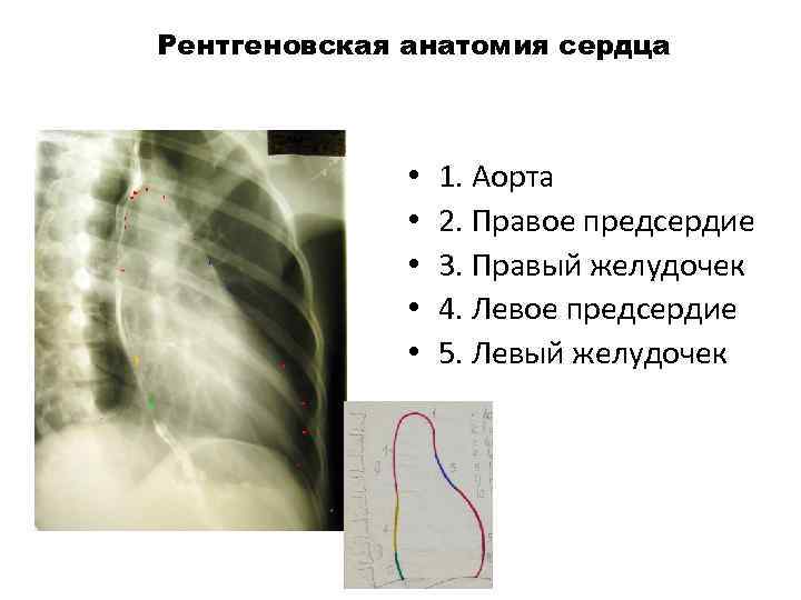 Рентгеновская анатомия сердца 1 3 5 7 • • • 1. Аорта 2. Правое