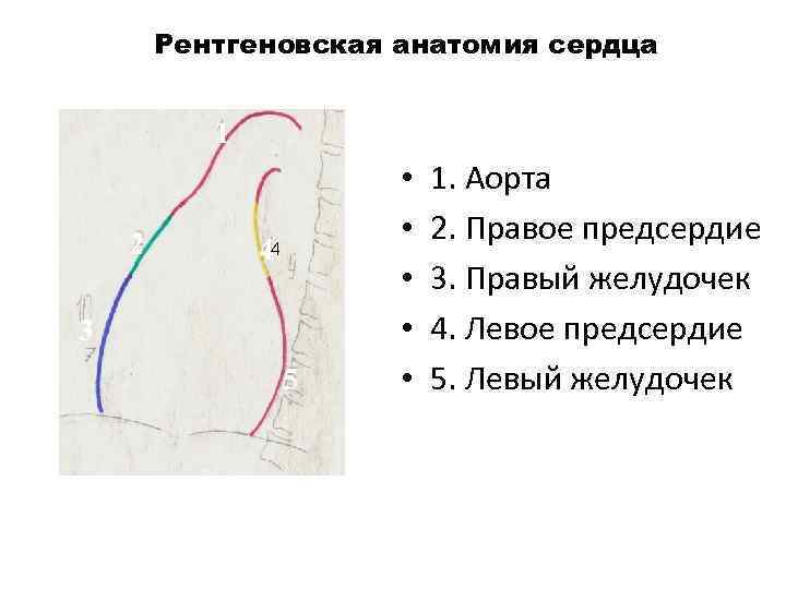 Рентгеновская анатомия сердца 11 2 44 3 5 5 7 • • • 1.