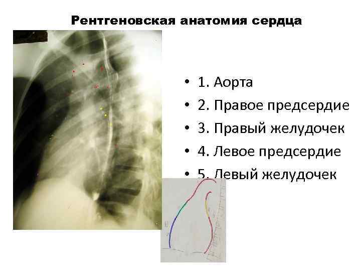 Рентгеновская анатомия сердца 1 4 1 5 7 • • • 1. Аорта 2.