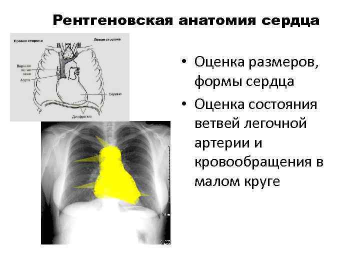 Рентгеновская анатомия сердца • Оценка размеров, формы сердца • Оценка состояния ветвей легочной артерии