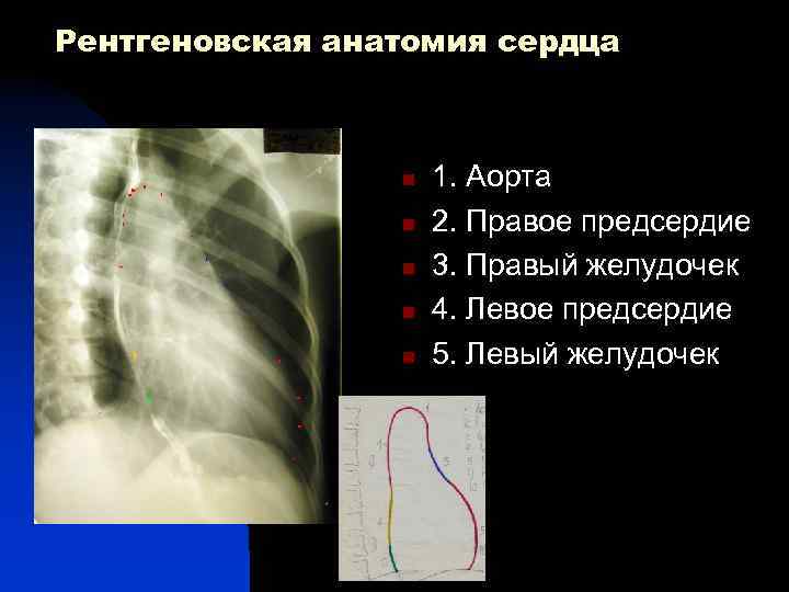 Рентгеновская анатомия сердца 1 n n 3 n n 5 7 n 1. Аорта