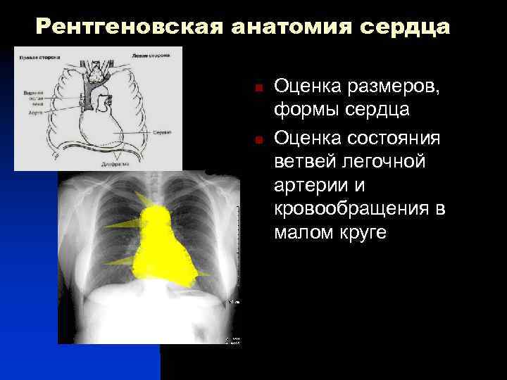 Рентгеновская анатомия сердца n n Оценка размеров, формы сердца Оценка состояния ветвей легочной артерии