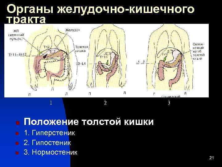 Гиперстом