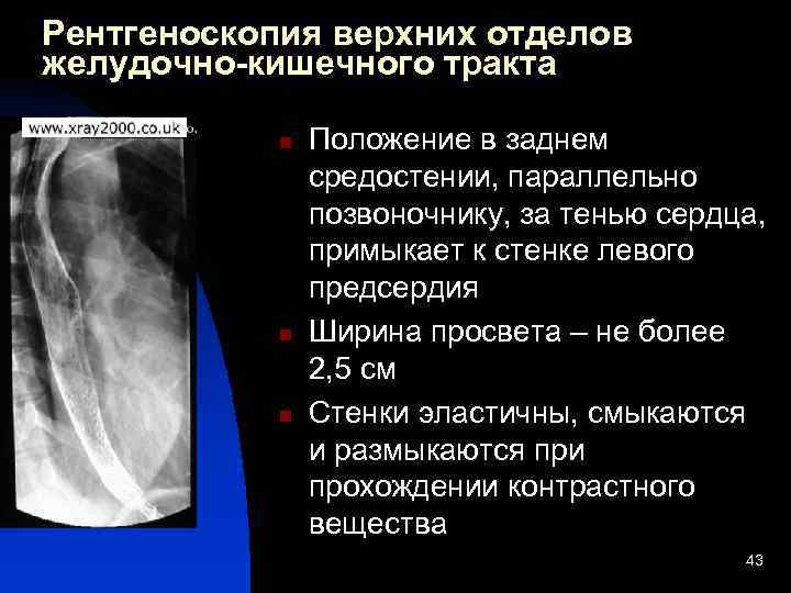 При рентгеноскопии изображение внутренних органов