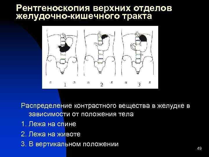 При рентгеноскопии изображение внутренних органов