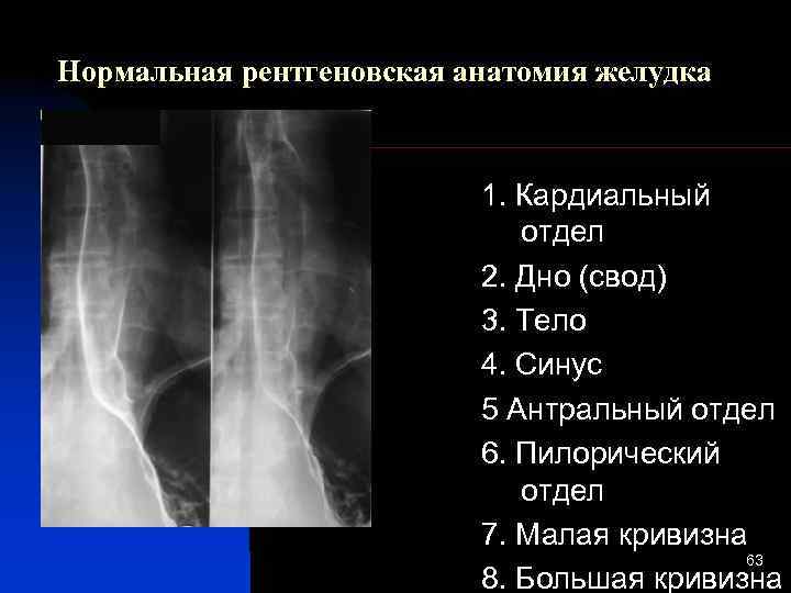 Анатомия рентген. Рентгеновская анатомия. Рентгеновская анатомия ЖКТ. Рентгенологическая анатомия желудка. Рентгеновское изображение желудка анатомия.