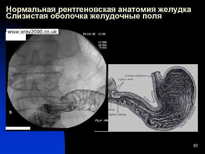 Анатомия рентген. Желудочные поля желудка. Слизистая желудка при рентгеноскопии.