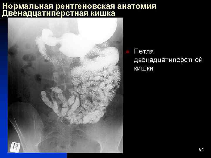 Рентгены анатомия. Анатомия двенадцатиперстной кишки рентген. Двенадцатиперстная кишка рентген анатомия. Рентгенодиагностика ЖКТ. Рентгенодиагностика функциональных нарушений ЖКТ.