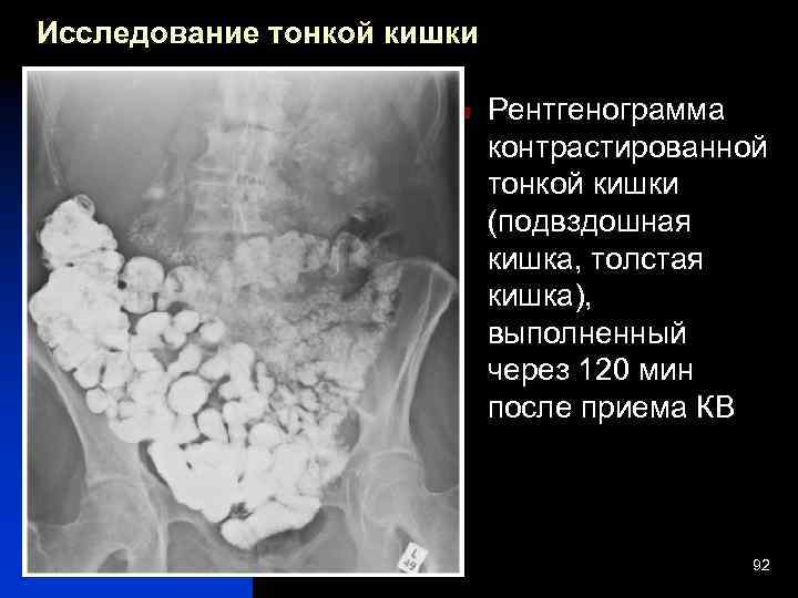 Исследование кишечных