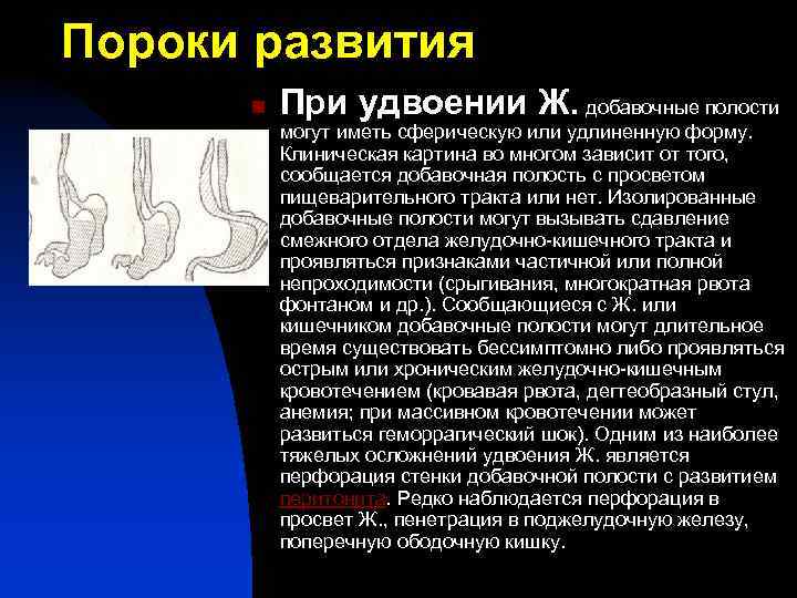 Пороки развития n При удвоении Ж. добавочные полости могут иметь сферическую или удлиненную форму.