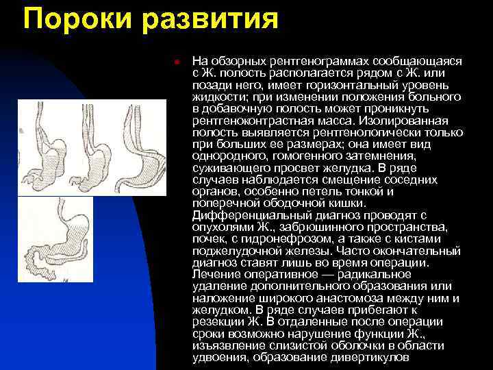 Пороки развития n На обзорных рентгенограммах сообщающаяся с Ж. полость располагается рядом с Ж.