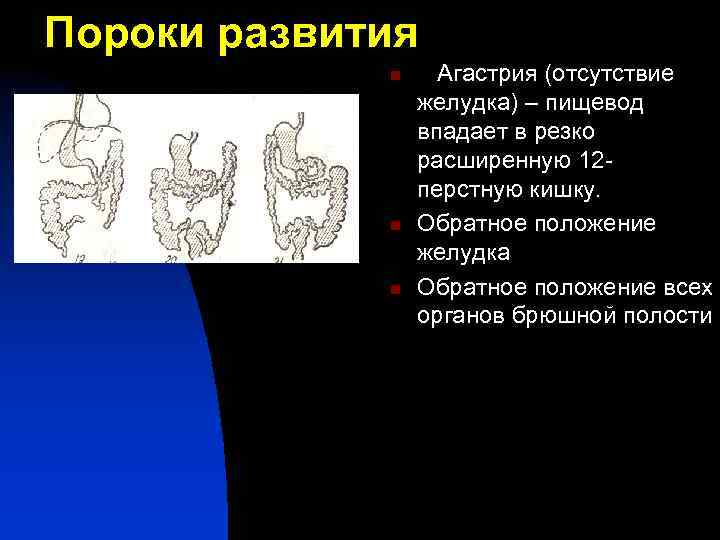 Положение желудка