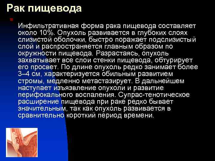 Рак пищевода симптомы. Инфильтративное заболевание пищевода. Инфильтративные изменения пищевода. Как распространяется опухоль. Как быстро распространяется опухоль языка.