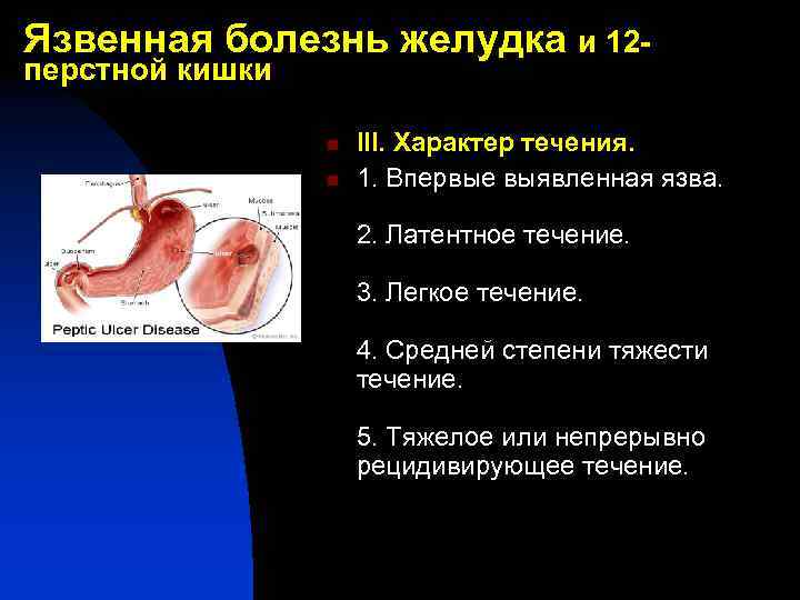 Язвенная болезнь желудка и 12 перстной кишки n n III. Характер течения. 1. Впервые