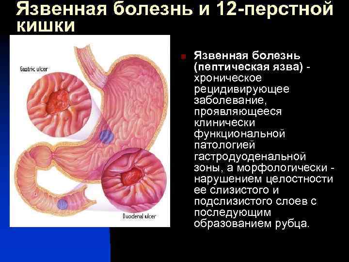 Воспаление бортовой железы фото