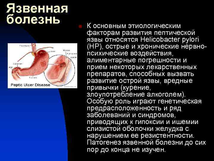 Язвенная болезнь n К основным этиологическим факторам развития пептической язвы относятся Helicobacter pylori (НР),