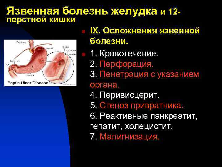 Язвенная болезнь желудка и 12 перстной кишки n n IX. Осложнения язвенной болезни. 1.