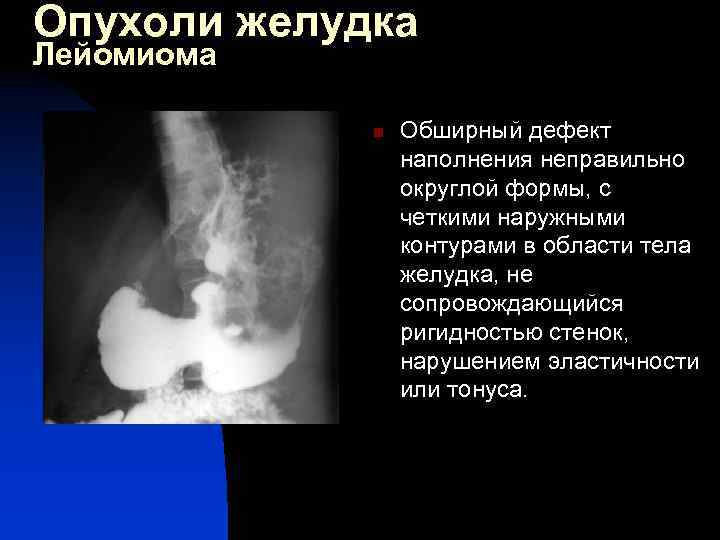 Мобилизация 12 перстной кишки по кохеру схема