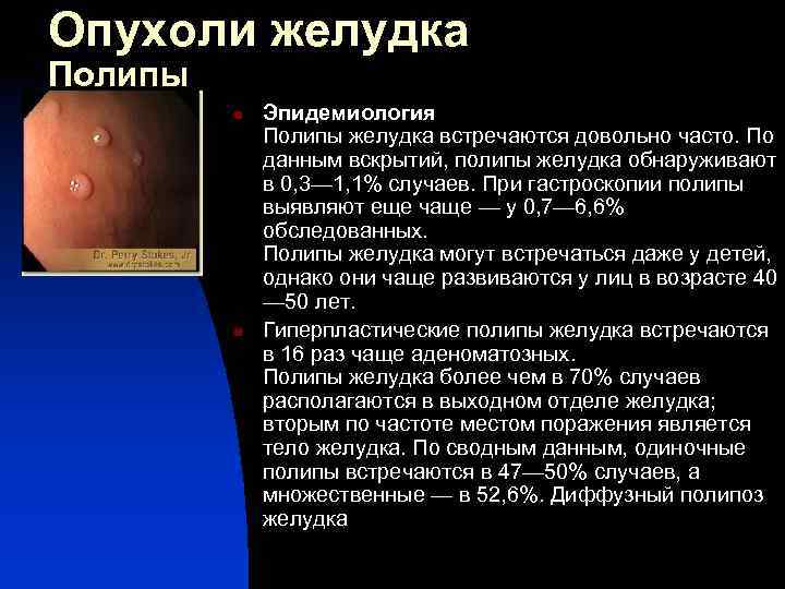 Опухоли желудка Полипы n n Эпидемиология Полипы желудка встречаются довольно часто. По данным вскрытий,