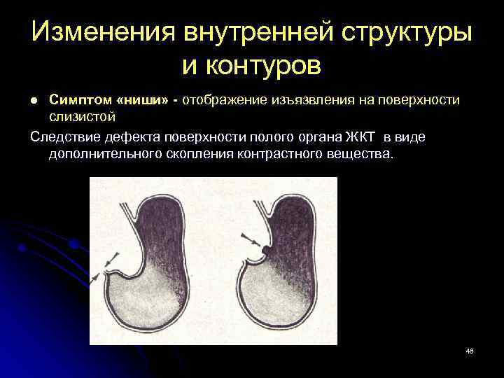 Изменение легочного рисунка по ячеистому типу