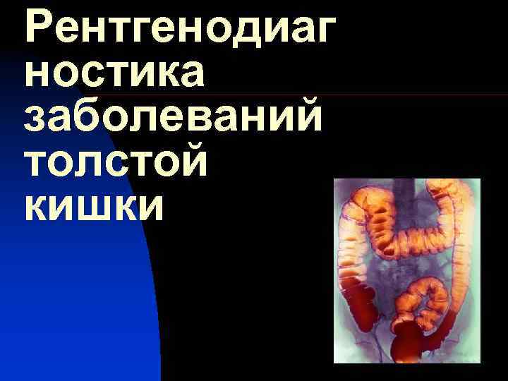 Рентгенодиаг ностика заболеваний толстой кишки 