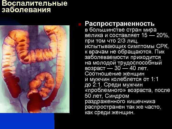 Воспалительные заболевания n Распространенность в большинстве стран мира велика и составляет 15 — 20%,