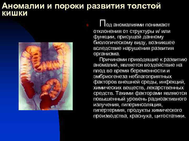 Аномалии и пороки развития толстой кишки n П од аномалиями понимают отклонения от структуры