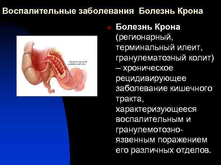 Метод диагностики заболевания толстой кишки изображенный на рисунке