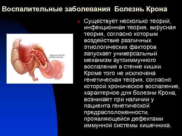Воспалительные заболевания Болезнь Крона n Существует несколько теорий, инфекционная теория, вирусная теория, согласно которым