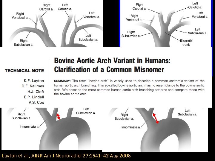 Normal 3 Br Layton et al. , AJNR Am J Neuroradiol 27: 1541– 42