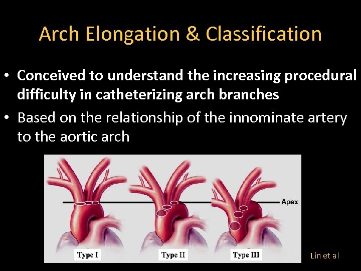 Arch Elongation & Classification • Conceived to understand the increasing procedural difficulty in catheterizing