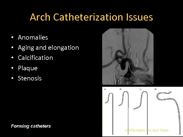 Arch Catheterization Issues • • • Anomalies Aging and elongation Calcification Plaque Stenosis Forming