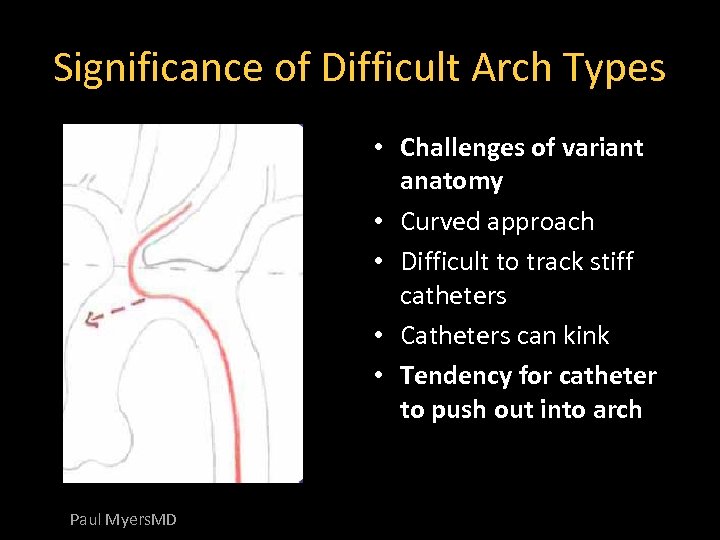 Significance of Difficult Arch Types • Challenges of variant anatomy • Curved approach •