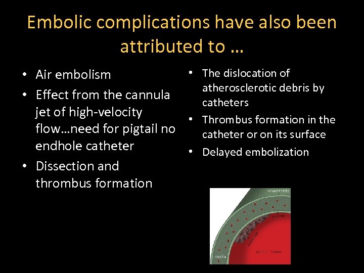 Embolic complications have also been attributed to … • The dislocation of • Air