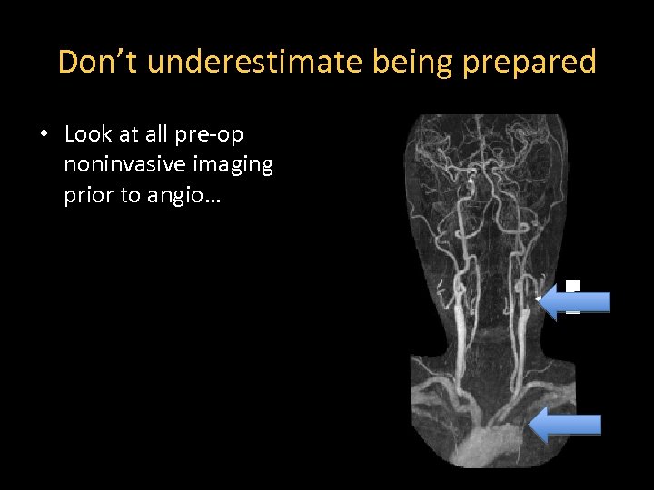 Don’t underestimate being prepared • Look at all pre-op noninvasive imaging prior to angio…