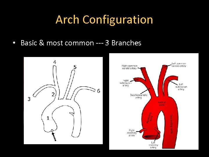 Arch Configuration • Basic & most common --- 3 Branches 