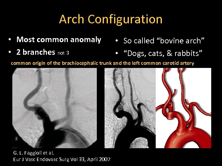 Arch Configuration • Most common anomaly • 2 branches not 3 • So called