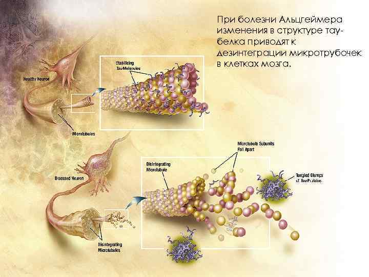 При болезни Альцгеймера изменения в структуре таубелка приводят к дезинтеграции микротрубочек в клетках мозга.