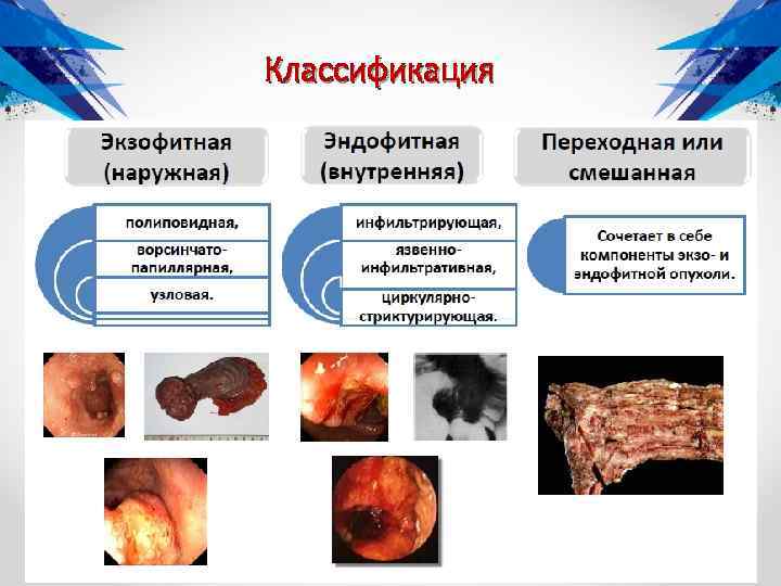 Классификация 