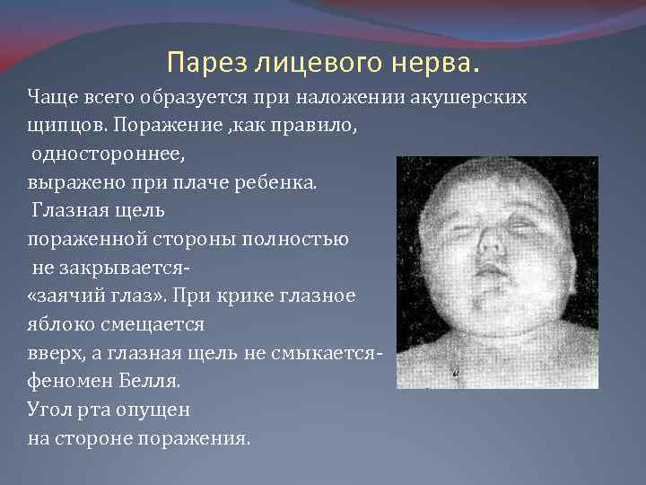 Парез лицевого нерва. Чаще всего образуется при наложении акушерских щипцов. Поражение , как правило,