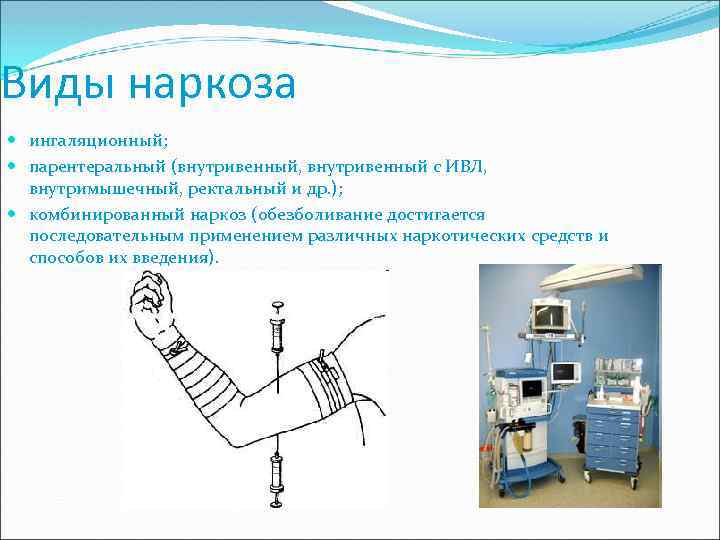 Виды наркоза ингаляционный; парентеральный (внутривенный, внутривенный с ИВЛ, внутримышечный, ректальный и др. ); комбинированный